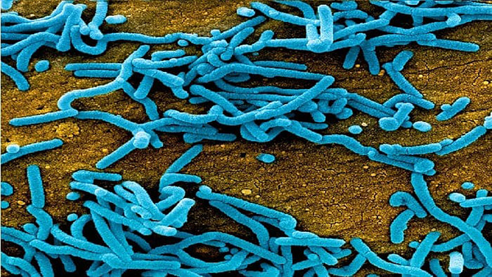 New Ebola vaccine development