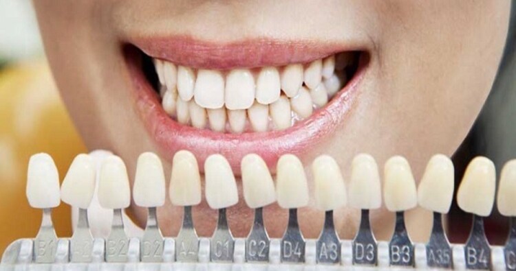 لون أسنانك يكشف صحتك: إشارات لا يجب تجاهلها