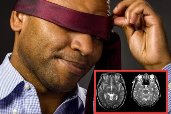 Rare Nervous Disorder Reveals Perception Insights